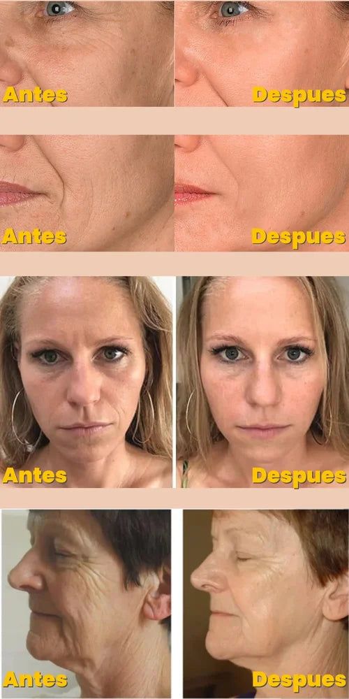 Serum Facial Antiarrugas